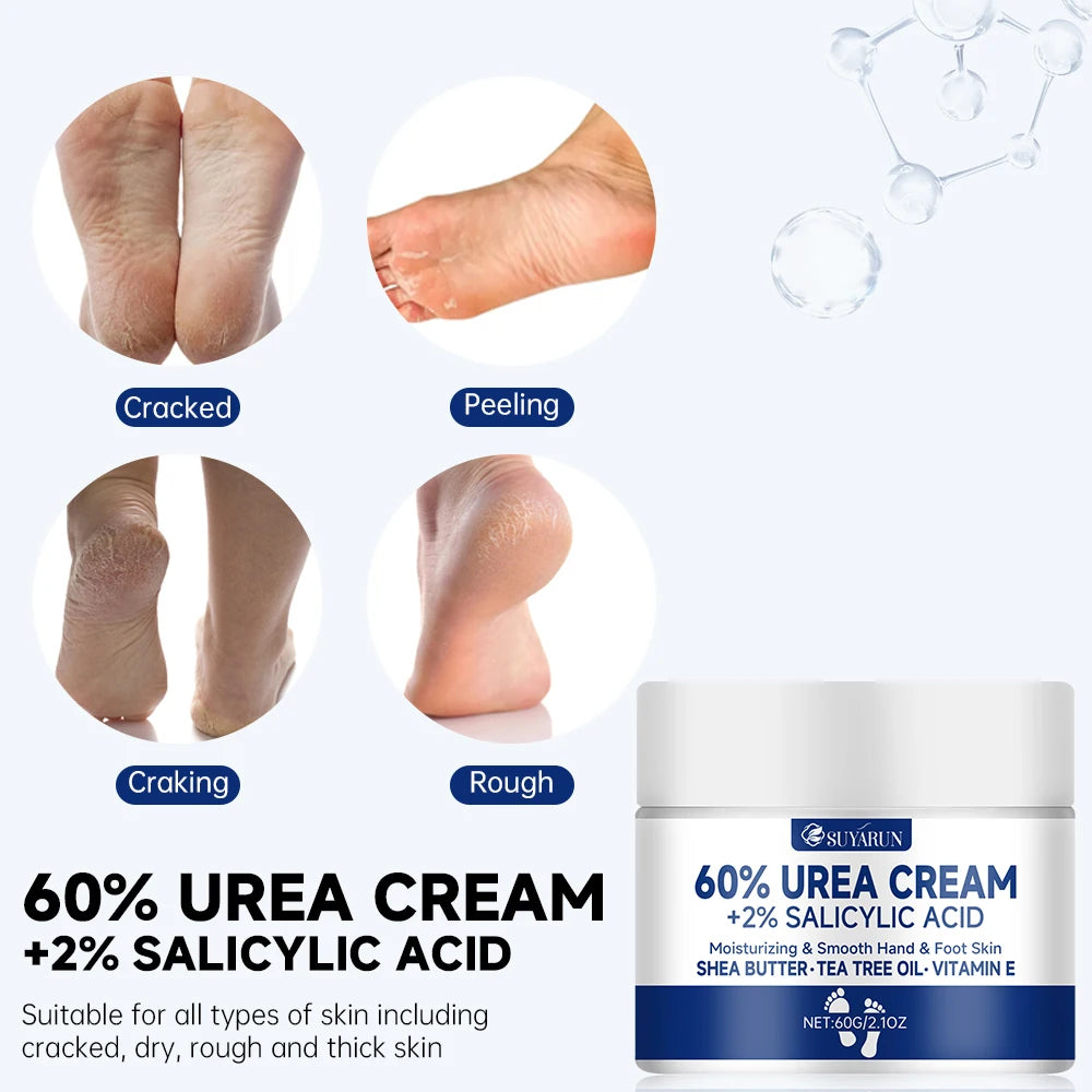 60% Urea Foot Cream for Cracked Heels & Dry Skin - Intensive Moisturizing Treatment, Callus Remover, Diabetic Foot Care. - GilloServ