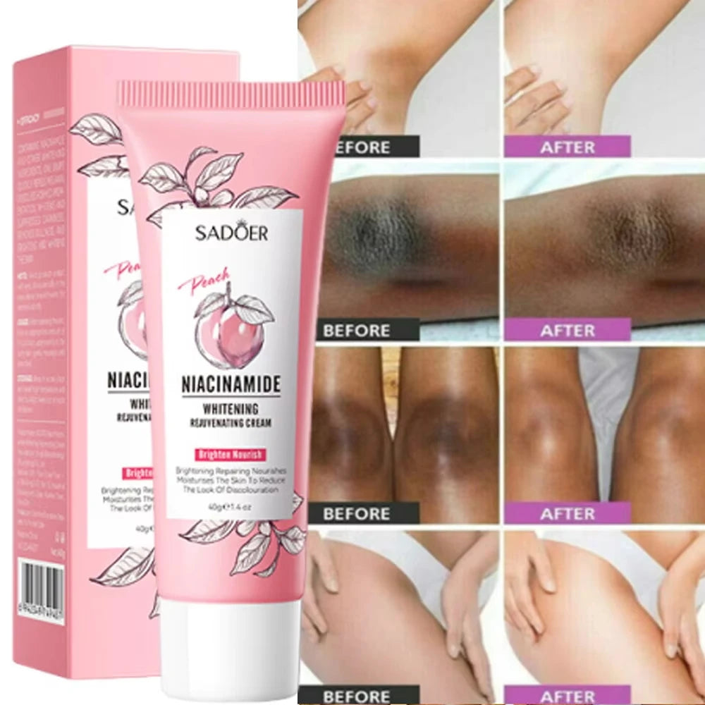 Whitening Cream Private Parts Underarm Butt Knee Whiten Inner Thigh Intimate Parts Dark Remove Melanin Woman Brighten Skin Care - GilloServ
